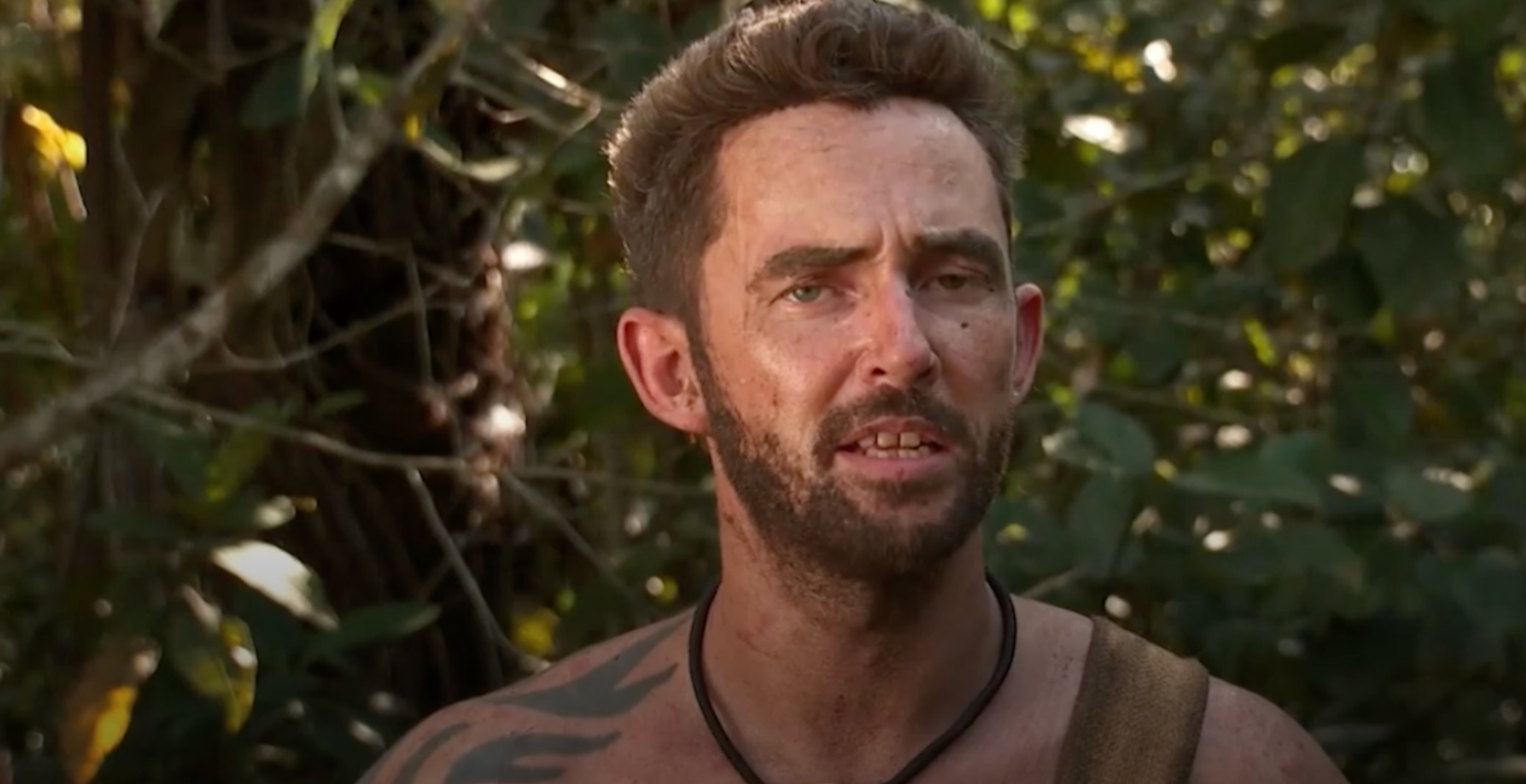 'Naked & Afraid' Star Talks Treatment For Wince-Inducing Injury